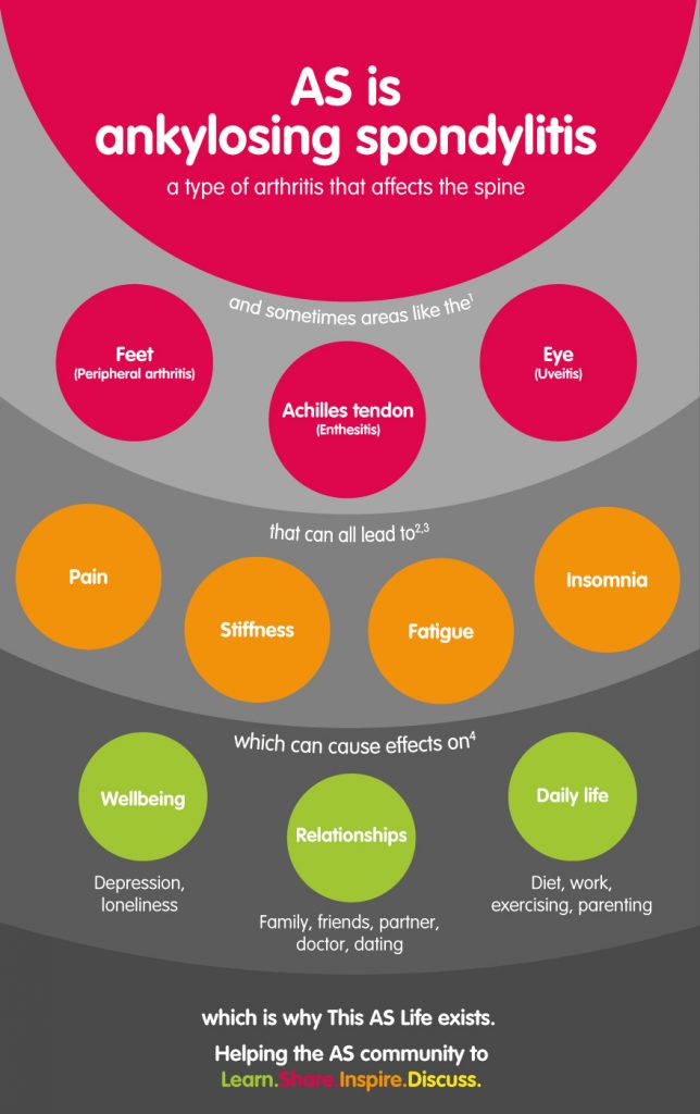 as-is-ankylosing-spondylitis